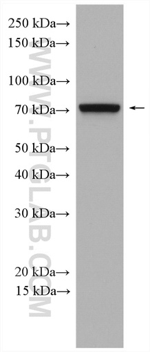 [27334-1-AP-20UL] IFT74 Polyclonal antibody