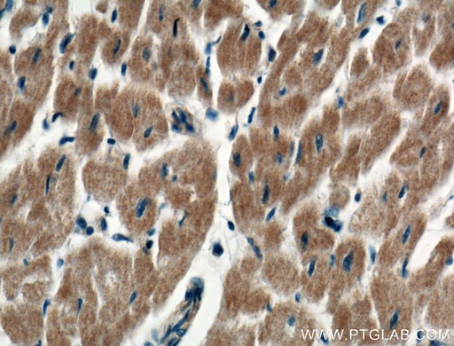 [27344-1-AP-150UL] RARS Polyclonal antibody