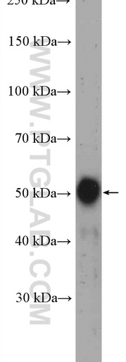 [27353-1-AP-150UL] GLTSCR2 Polyclonal antibody