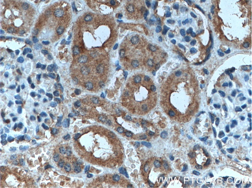 [27355-1-AP-20UL] AP50 Polyclonal antibody