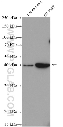 [27372-1-AP-20UL] CYSLTR1 Polyclonal antibody
