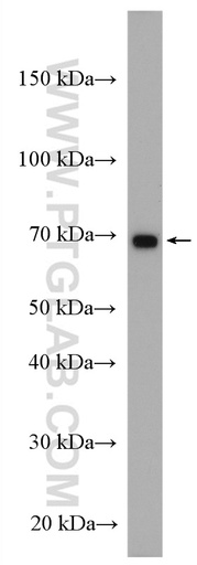 [27377-1-AP-150UL] IL-2RG Polyclonal antibody