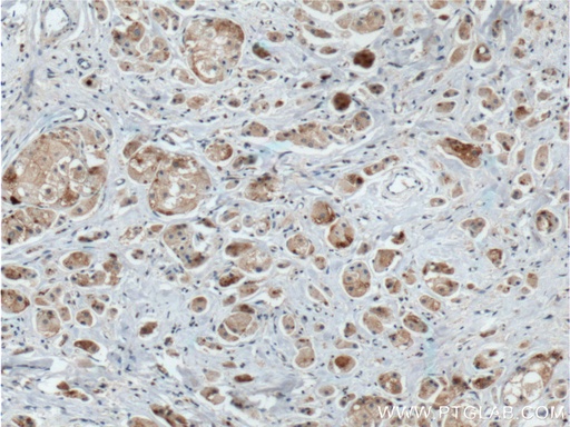 [27384-1-AP-20UL] DVL1 Polyclonal antibody