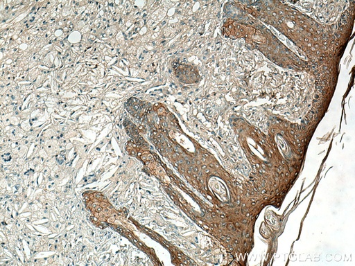 [27387-1-AP-20UL] ABI1 Polyclonal antibody