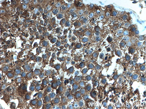 [27398-1-AP-150UL] PRKACA Polyclonal antibody