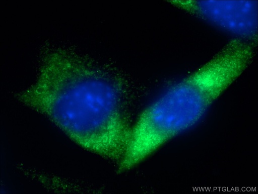 [27403-1-AP-20UL] RAB5B Polyclonal antibody