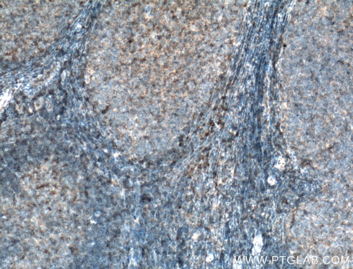 [27411-1-AP-20UL] HLA-E Polyclonal antibody
