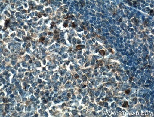 [27415-1-AP-150UL] TSEPA Polyclonal antibody