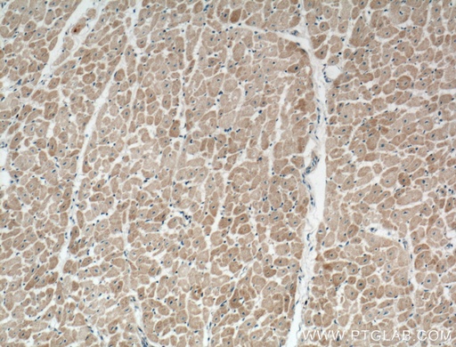 [27426-1-AP-150UL] NPPA Polyclonal antibody