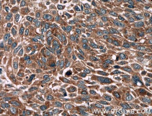 [27431-1-AP-150UL] BRAP Polyclonal antibody