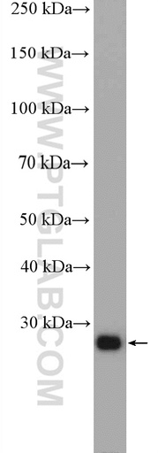 [27435-1-AP-150UL] RAB34 Polyclonal antibody