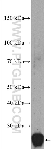 [27447-1-AP-20UL] C21orf70 Polyclonal antibody