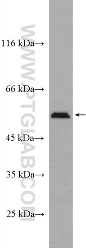 [27449-1-AP-20UL] SELENBP1 Polyclonal antibody