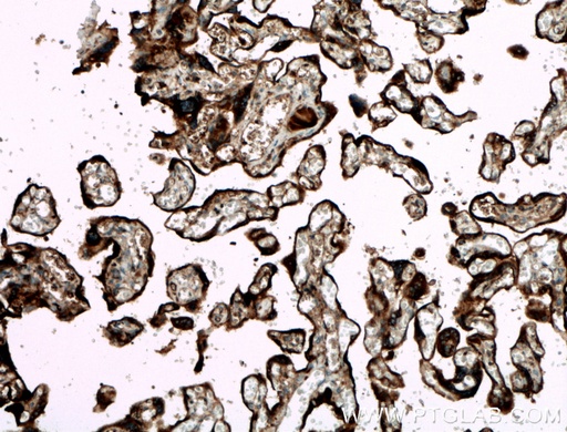 [27455-1-AP-150UL] GDF15 Polyclonal antibody