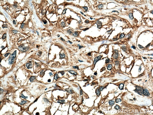 [27457-1-AP-20UL] RRAS Polyclonal antibody