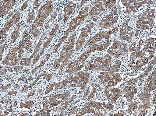 [27467-1-AP-20UL] ATG4A Polyclonal antibody