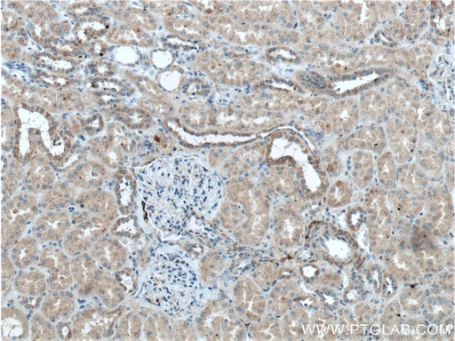 [27477-1-AP-20UL] Kininogen 1 Polyclonal antibody