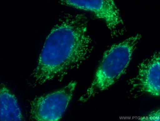 [27484-1-AP-150UL] MRPL4 Polyclonal antibody