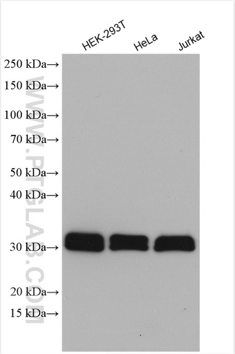 [27489-1-AP-20UL] TMX1 Polyclonal antibody