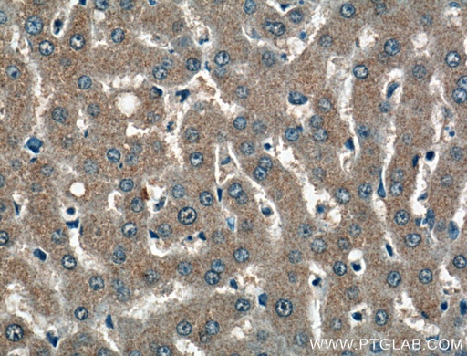 [27490-1-AP-150UL] PDXP Polyclonal antibody