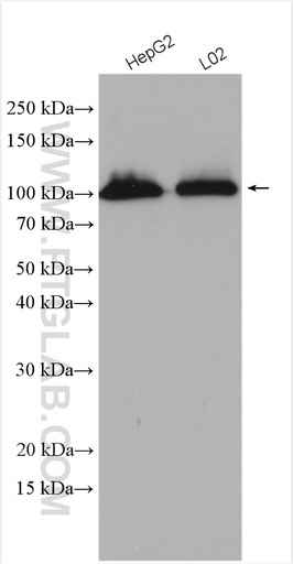 [27493-1-AP-20UL] DHTKD1 Polyclonal antibody