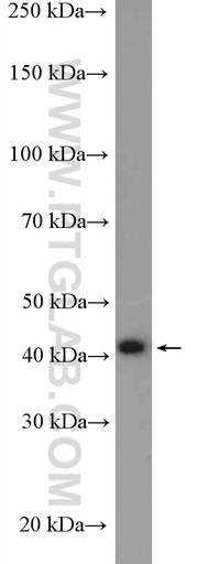 [27497-1-AP-150UL] Reticulocalbin 3 Polyclonal antibody
