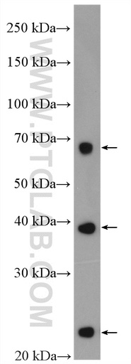 [27499-1-AP-20UL] SLC31A1 Polyclonal antibody