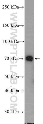[27500-1-AP-20UL] DDX41 Polyclonal antibody