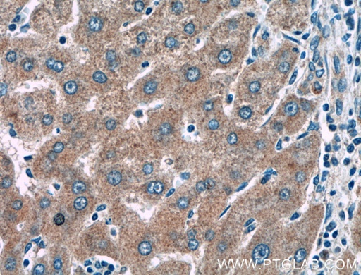 [27515-1-AP-20UL] KLK15 Polyclonal antibody