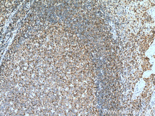 [27516-1-AP-150UL] CD100 Polyclonal antibody