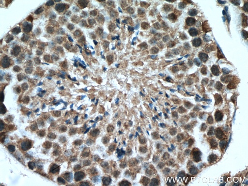 [27522-1-AP-20UL] USP29 Polyclonal antibody
