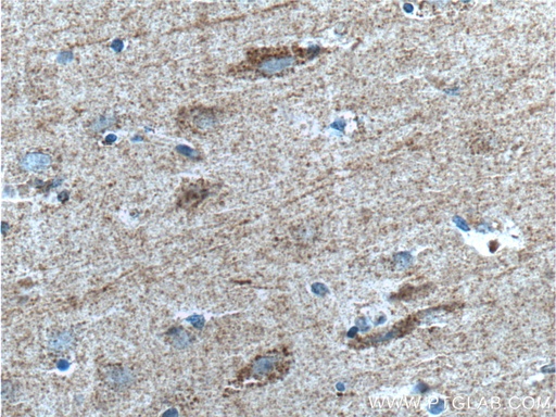[27537-1-AP-20UL] SYNDIG1 Polyclonal antibody