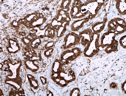[27543-1-AP-150UL] Livin Polyclonal antibody