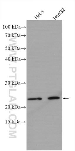 [27550-1-AP-150UL] C15orf24 Polyclonal antibody