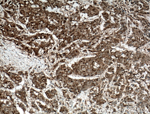 [27552-1-AP-20UL] Galectin-4 Polyclonal antibody