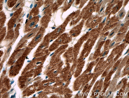 [27554-1-AP-20UL] AKD2 Polyclonal antibody