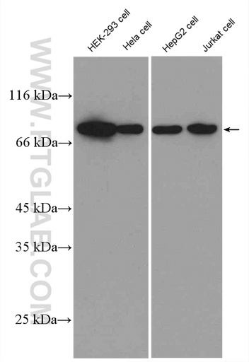 [27558-1-AP-20UL] Alpha Taxilin Polyclonal antibody