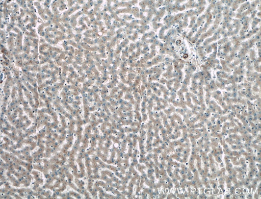 [27566-1-AP-150UL] TAB1 Polyclonal antibody
