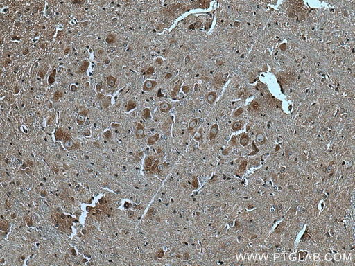 [27567-1-AP-20UL] GABBR2 Polyclonal antibody