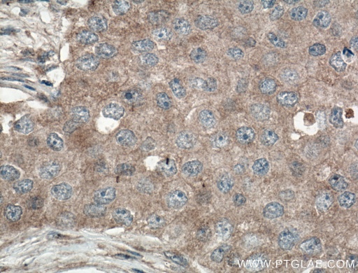 [27571-1-AP-20UL] GLUT5 Polyclonal antibody