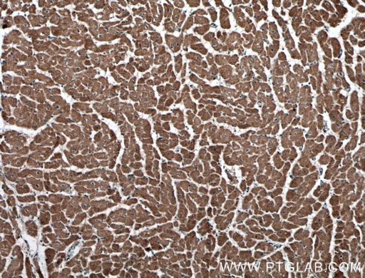 [27587-1-AP-150UL] RYR2 Polyclonal antibody