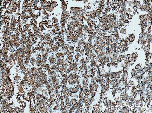 [27593-1-AP-150UL] HAI-1 Polyclonal antibody