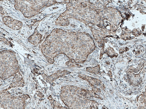 [27595-1-AP-20UL] C3orf64 Polyclonal antibody