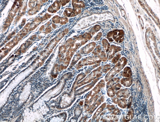 [27597-1-AP-150UL] LRBA Polyclonal antibody