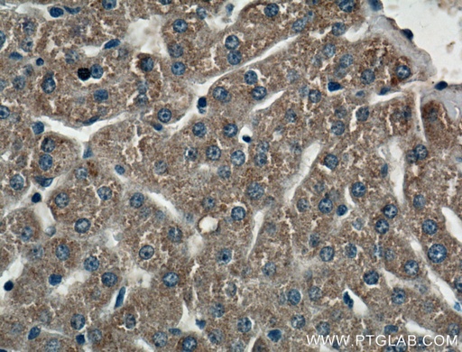 [27600-1-AP-150UL] CIDEB Polyclonal antibody