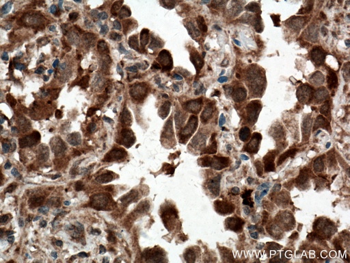 [27609-1-AP-20UL] C21orf2 Polyclonal antibody
