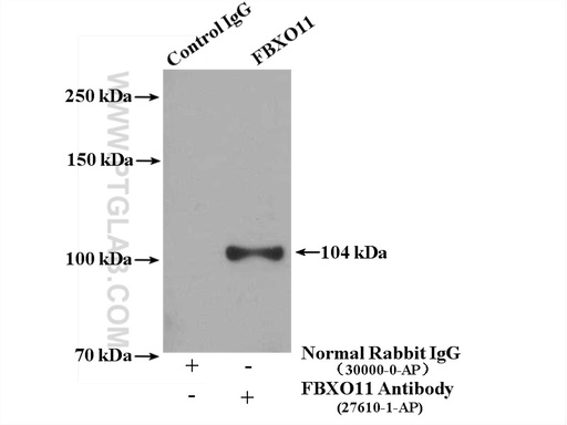 [27610-1-AP-20UL] FBXO11 Polyclonal antibody