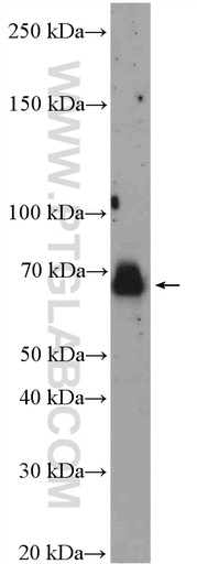 [27615-1-AP-150UL] E2F3 Polyclonal antibody