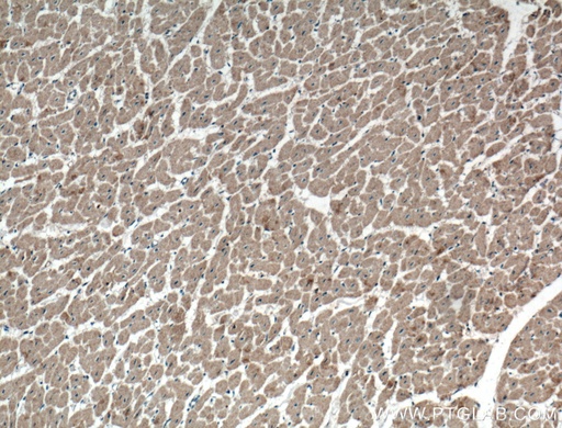 [27628-1-AP-150UL] WDR8 Polyclonal antibody