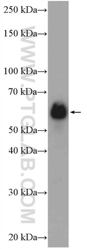[27631-1-AP-20UL] HSPBAP1 Polyclonal antibody